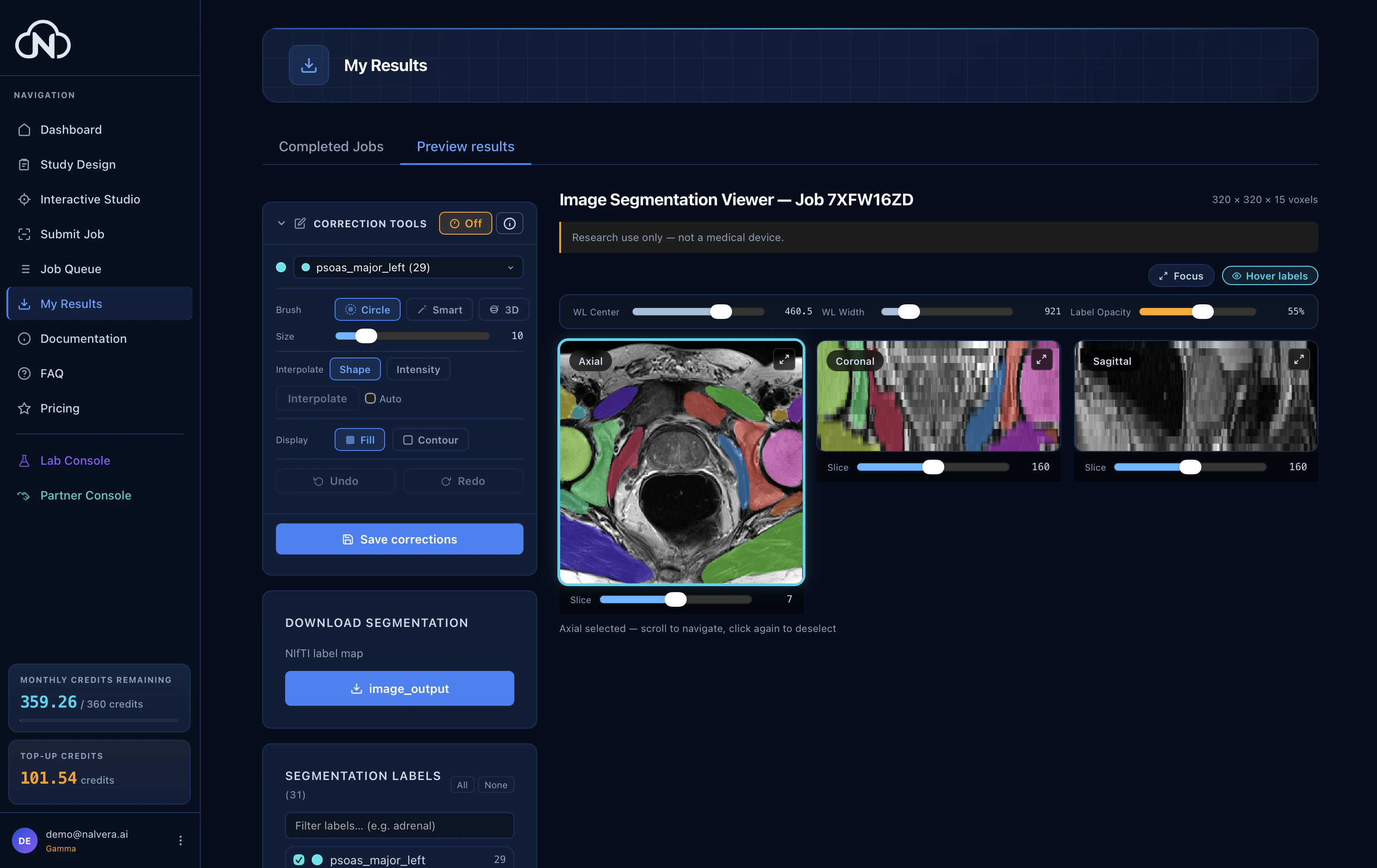 Preview results — correction toolkit open on an MR muscle segmentation