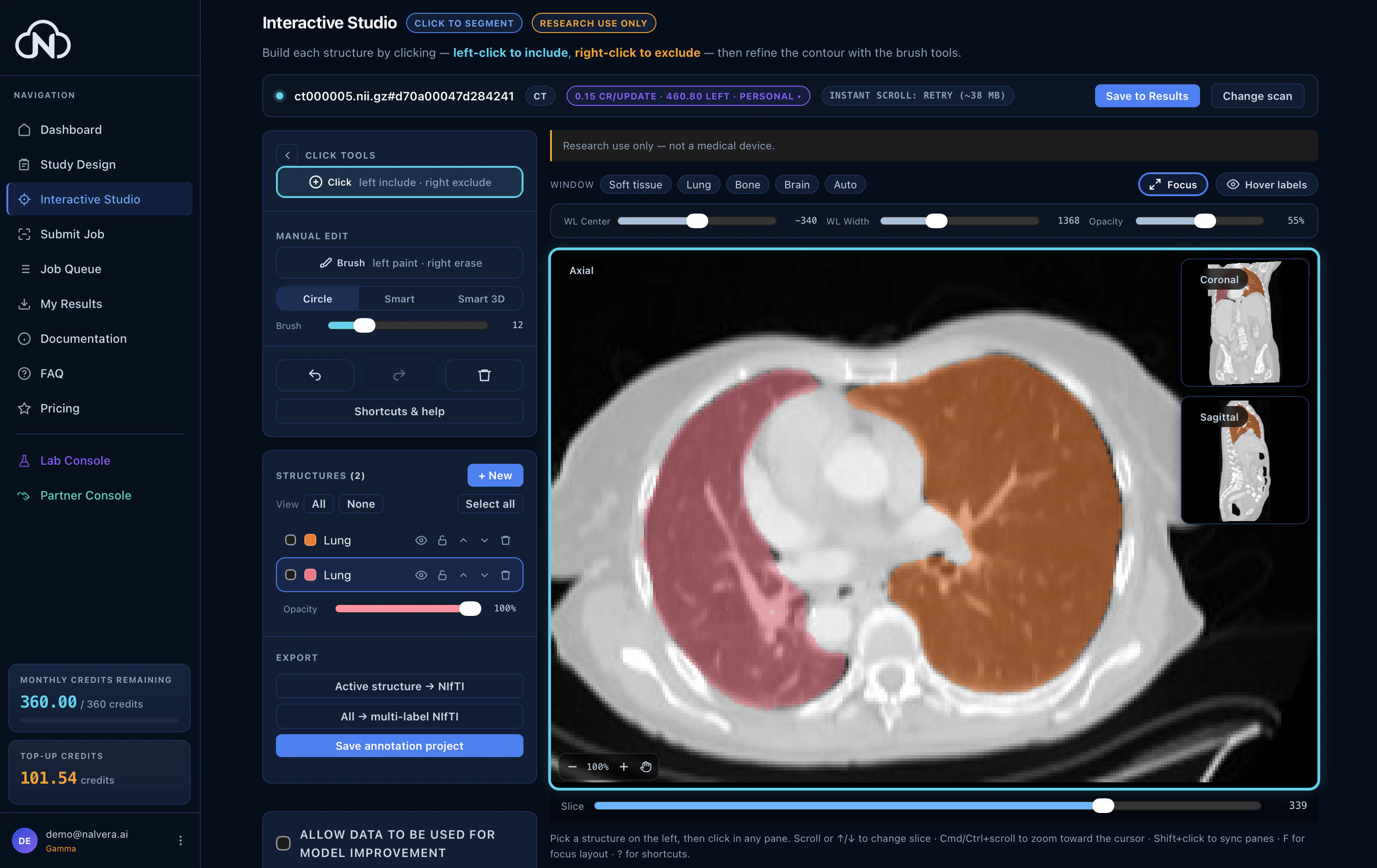 Interactive Studio — click-to-segment on a chest CT