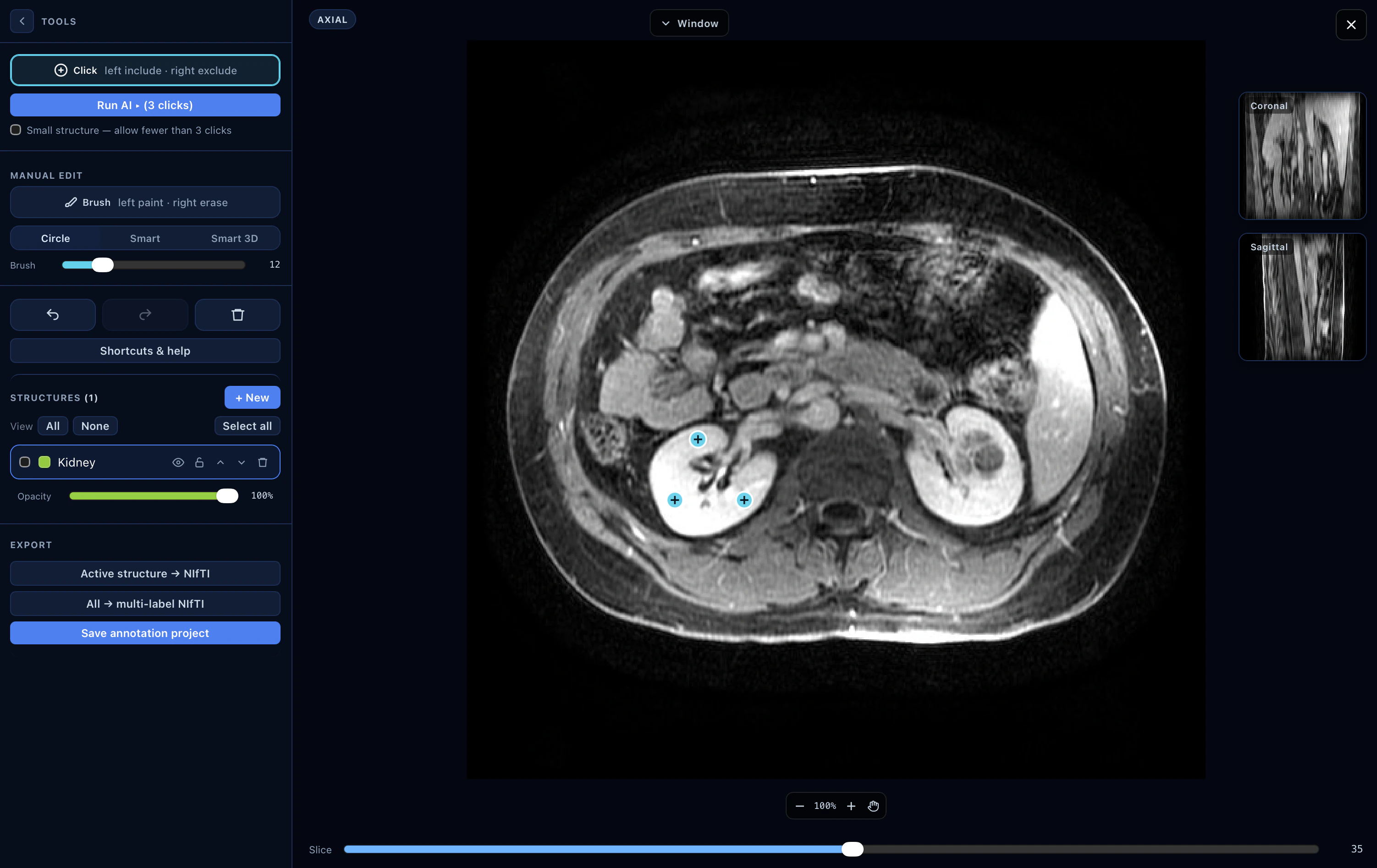 Interactive Studio — staging AI clicks on a kidney MR