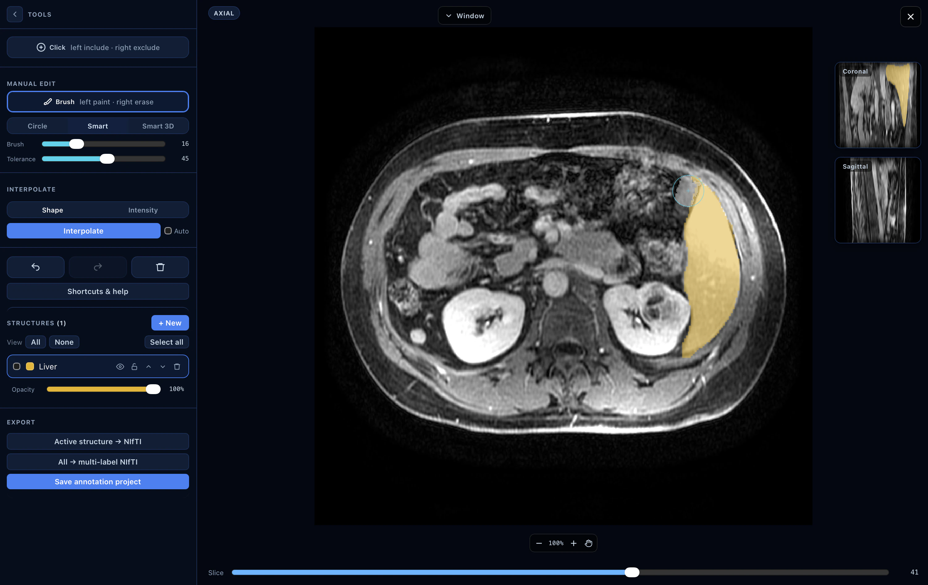 Interactive Studio — smart brush refining a liver contour on MR